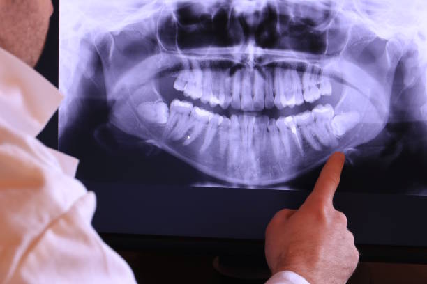 Best Emergency Root Canal Treatment in Lancaster, KY